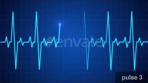 EKG Pulse Display Set | Motion Graphics - Envato elements
