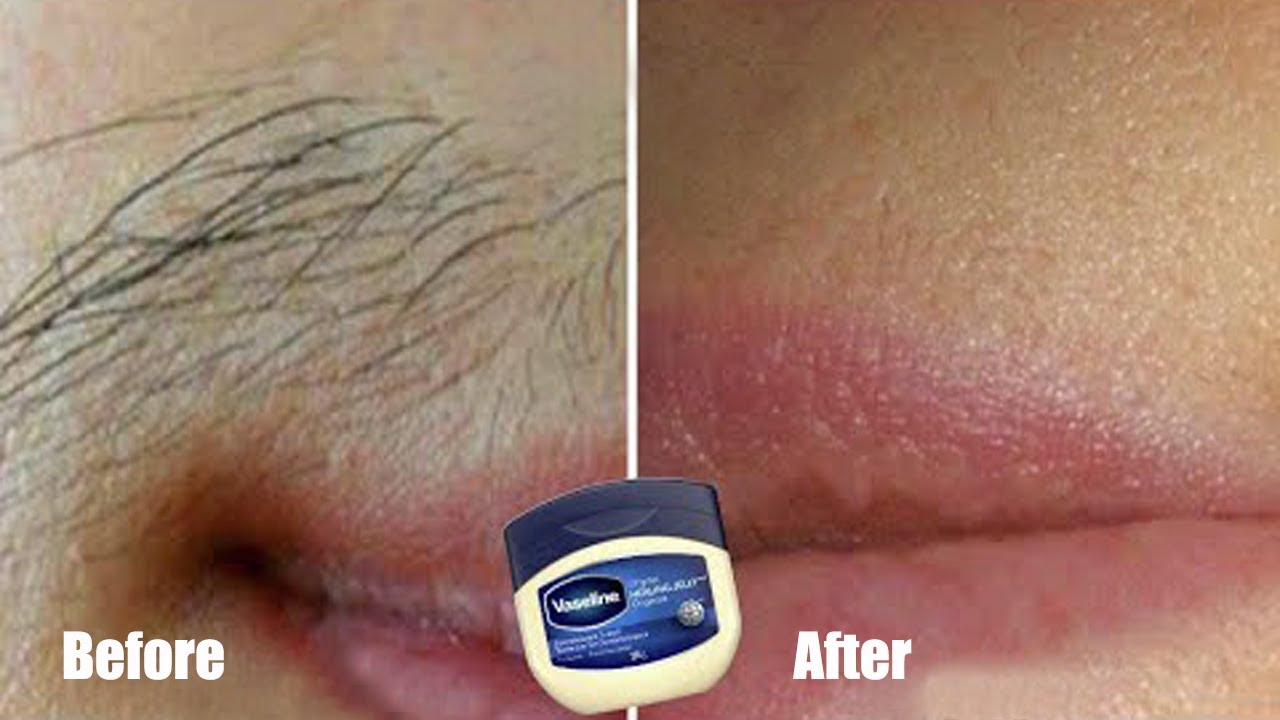 How to use Vaseline to permanently get rid of unwanted hair on the face and body. YouTube