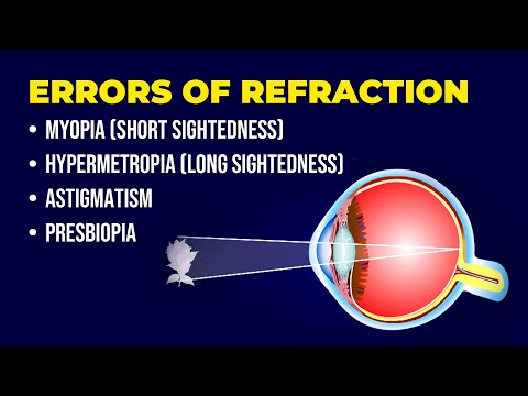 Errors of Refraction | Myopia | Hypermetropia | Astigmatism | Presbiopia | Short & Long Sightedness