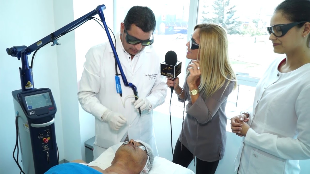 Tratamiento con laser CO2 para eliminar lunares