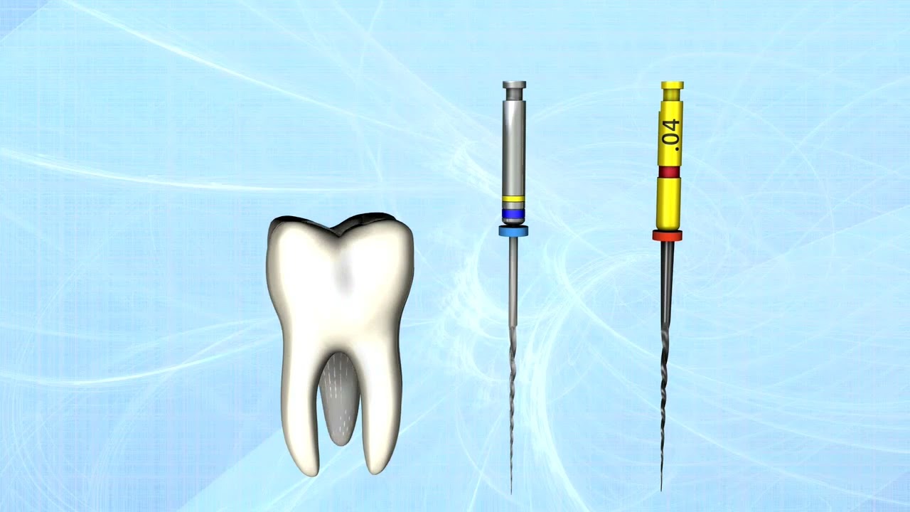 Hyflex CM Superior Canal Tracking Rotary Files | pinkblue
