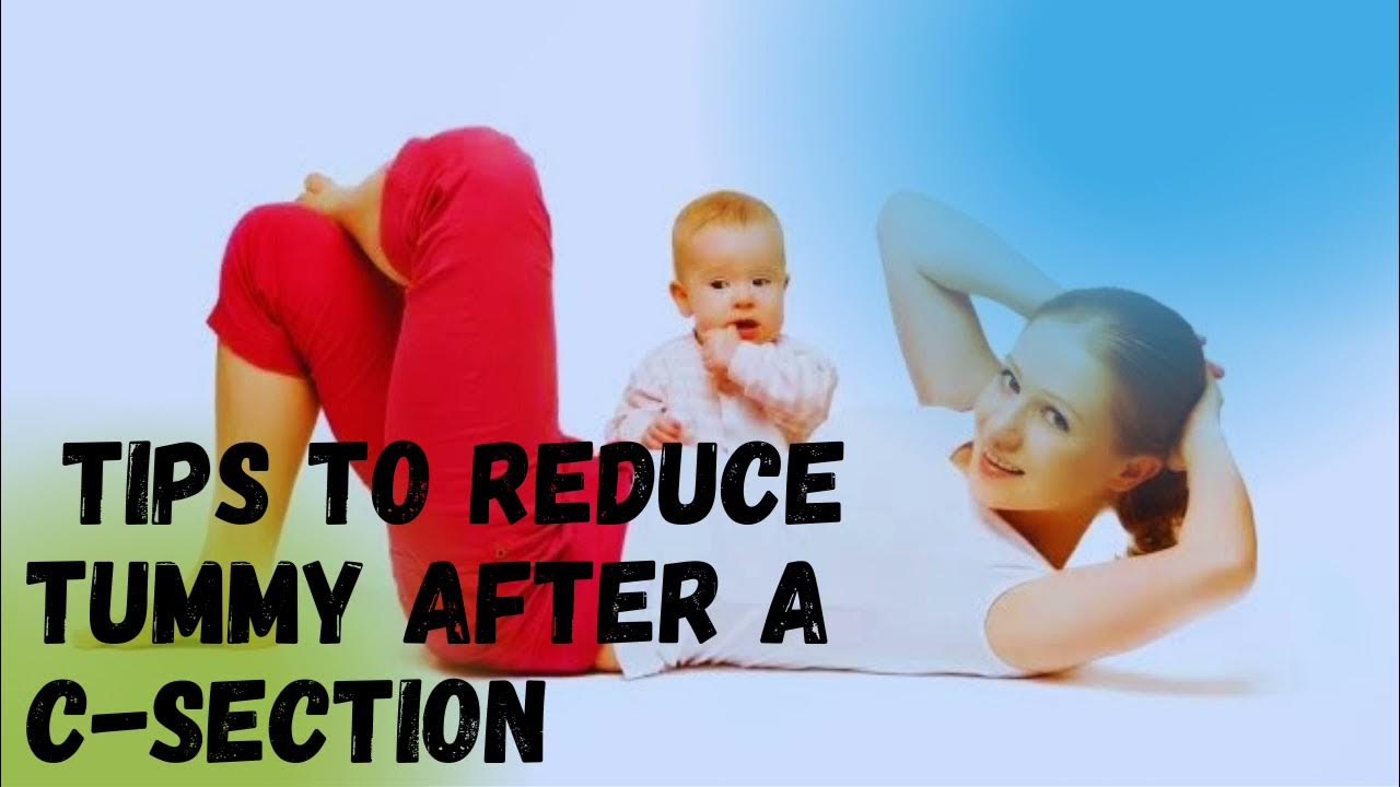 tips-to-reduce-tummy-after-c-section-how-to-reduce-stomach-after-c