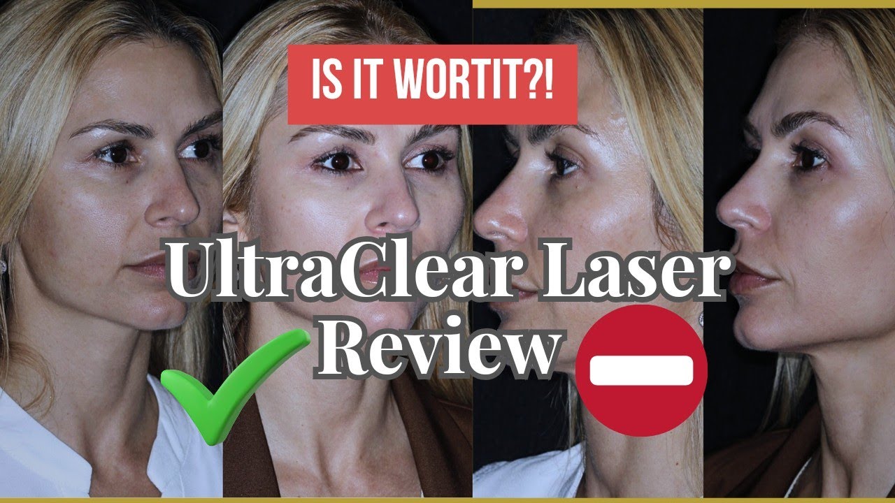 📢UltraClear Laser Review /Results📢 Is it Worth It?! @CityMediSpa London
