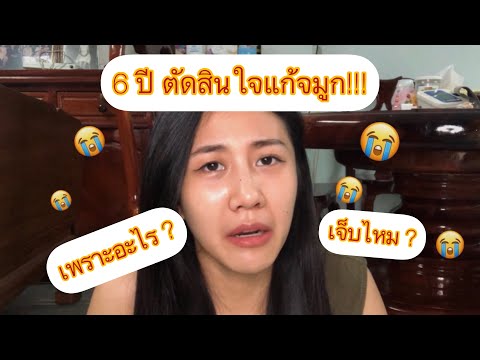 6ปี ตัดสินใจแก้จมูก! แก้จมูกเจ็บมากไหม