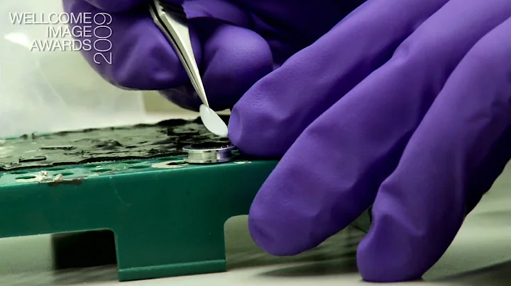 Scanning electron microscopy