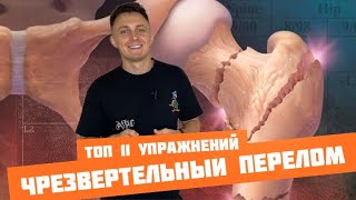 ЧТО ДЕЛАТЬ ПРИ ЧРЕЗВЕРТЕЛЬНОМ ПЕРЕЛОМЕ? Это вам поможет восстановиться