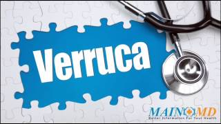 Verruca ¦ Treatment and Symptoms