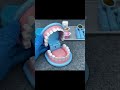 Satisfying with Unboxing Cute Doctor Dentist Playset P4, ASMR video Joy Unboxing #shorts #toys #unbo