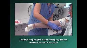 Burns 402: Elbow Splints