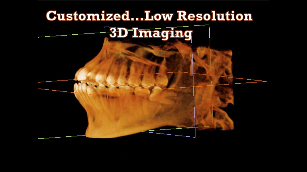 Dental Treatment Why Cone Beams Are Essential to General Dentistry Jan