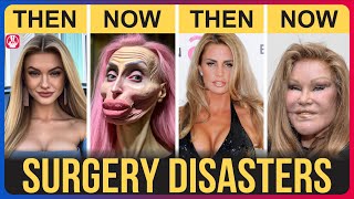 20 Celebrity Plastic Surgery Disasters | You’d Never Recognize Today