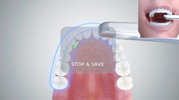 3M True Definition Scanner Full Arch Animation