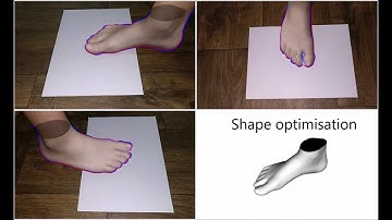 Data-driven 3D reconstruction of a foot from three photographs