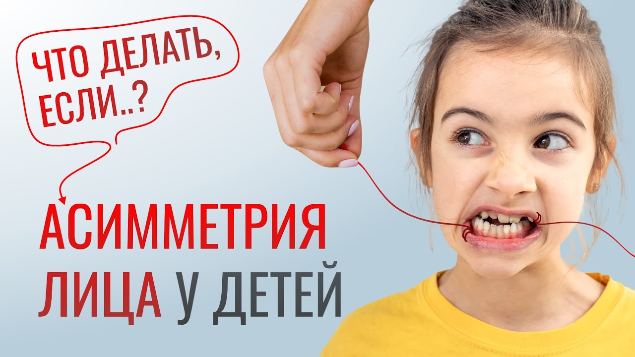 АСИММЕТРИЯ ЛИЦА У РЕБЁНКА. ВИНОВАТ ЛИ ПРИКУС?