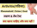 Arthritis in Hindi | Rheumatoid arthritis in hindi | Arthritis Symptoms | Arthritis Treatment