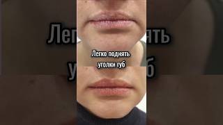 Легко поднять уголки губ и убрать морщины "марионетки".