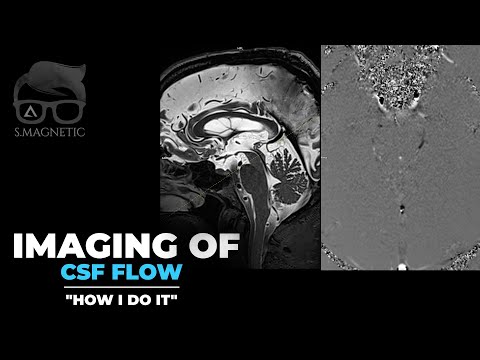 IMAGING OF CSF FLOW – “HOW I DO IT”