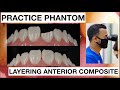 STEP BY STEP HOW TO DIRECT COMPOSITE RESTORATION WITH CLASS IV | General Dentist Griya RR