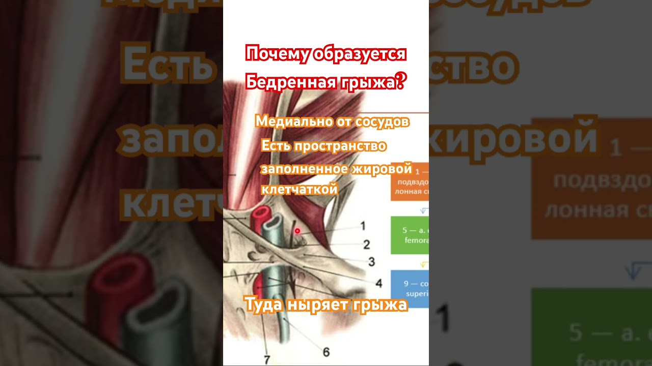 Почему образуется бедренная грыжа #анатомиячеловека #бедро #канал #грыжа