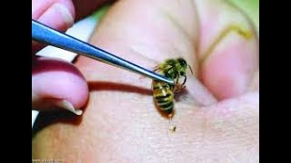 سم النحل أو مصل النحل وفوائده وتأثيره في القضاء على آلام المفاصل