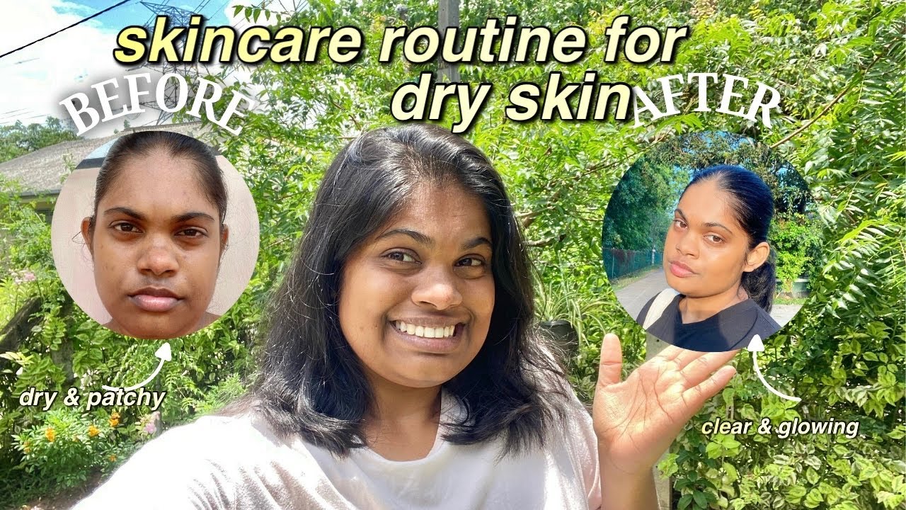 how I TRANSFORMED my skin into a CLEAR & GLOWING SKIN in 2 WEEKS 💕 ...