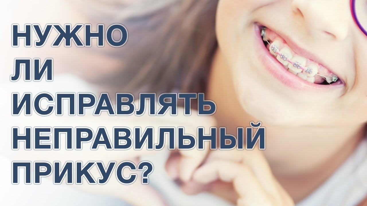 Неправильный прикус. Нужно ли исправлять прикус? - YouTube