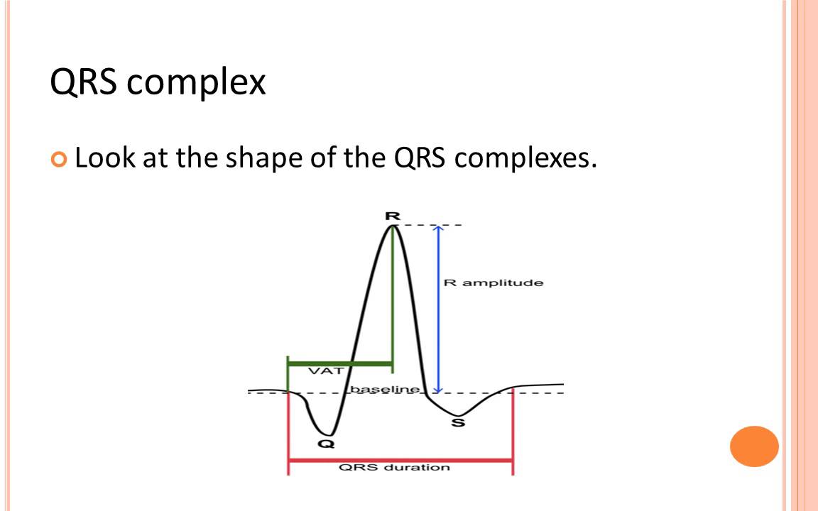 Basic ecg rhythm interpretation by junainah nor part 1 youtube