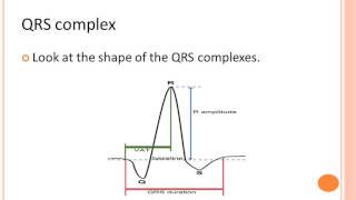 Basic ECG Rhythm Interpretation by Junainah Nor Part 1