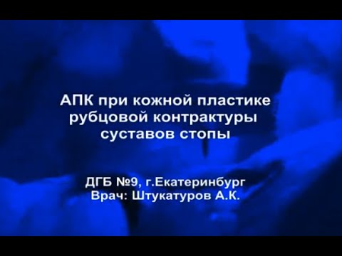 Кожная пластика рубцовой контрактуры стопы