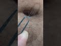 dog fur in belly button part 4