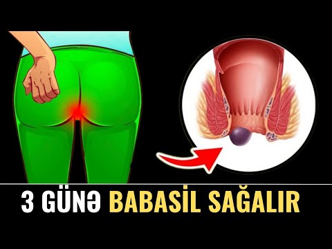 Babasili təbii yolla 3 GÜNƏ SAĞALDIR