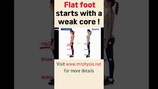 Flat feet.. tight calf.. all start from this!