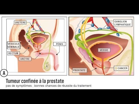 îmbolnăvire en français - Roumain-Français dictionnaire | Glosbe