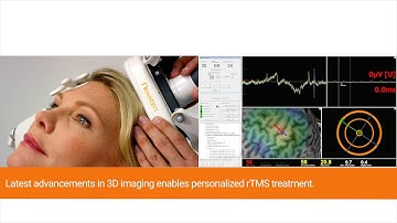 Nexstim SmartFocus® TMS—a new treatment for neuropathic pain (short video)