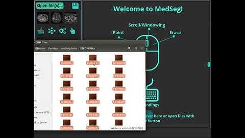 Converting DICOM to nifti in the web-browser