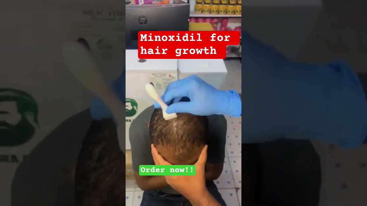 Minoxidil Liquid Solution