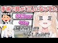 まさかの初診で目の手術を受けて目が「三」になってしまい周囲を爆笑させていた風真殿【風真いろは/ホロライブ切り抜き/holoX】