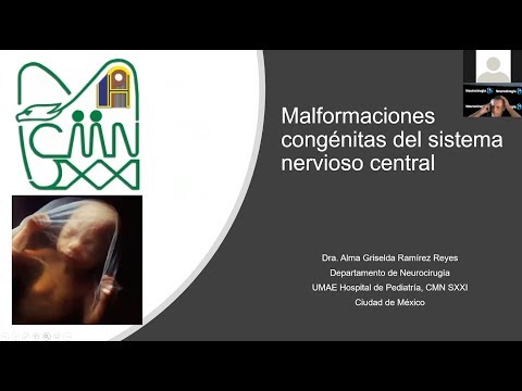 Malformaciones Congenital del Sistema Nerioso Central -  Alma Griselda Ramirez Reyes