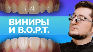 Виниры И B.o.p.t - Дентал Кейсы