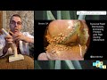 العلاج المنزلي لمفصل الركبة - الجزء الأول // Home treatment of the knee joint - part 1