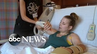 Lindsay Ess' Story Part 1: Quadruple Amputee Undergoes Double Hand Transplant Surgery