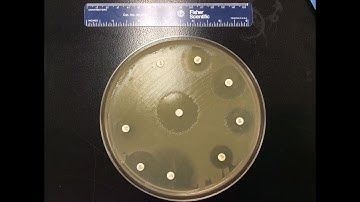 Pathology CPT codes Microbiology Part 4 - simplify medical coding