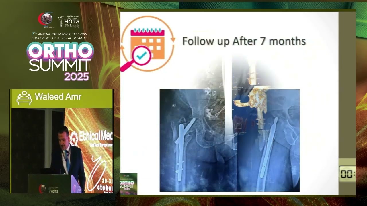 Ortho Summit 2025 Dr Waleed Amr - Panel Discussion