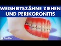 Weisheitszähne ziehen und Perikoronitis ©