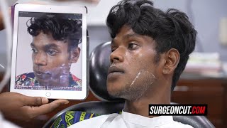 How to Get a Chiseled Jawline (For Boys) - Surgical Method