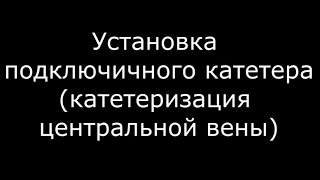 Установка подключичного катетера - meduniver.com(Остальное видео: http://meduniver.com/Medical/Video/ Последние новинки на вашем сайте: http://meduniver.com/, 2015-06-02T07:37:12.000Z)