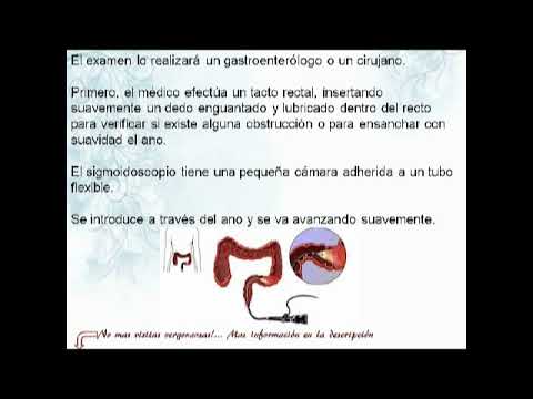 Vídeo: Sigmoidoscopia: Indicaciones, Complicaciones, Preparación