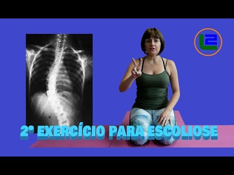 # Exercícios de Pilates para Escoliose - Parte 2