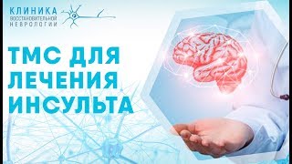 ТМС для диагностики и лечения инсульта