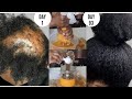 Her hair was completely DAMAGED & HELPLESS Until she found my recipe on Youtube *3 MONTHS LATER